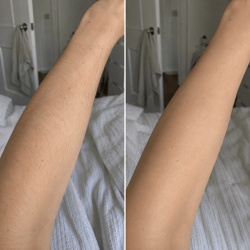 Goodbye Razor Burn.
